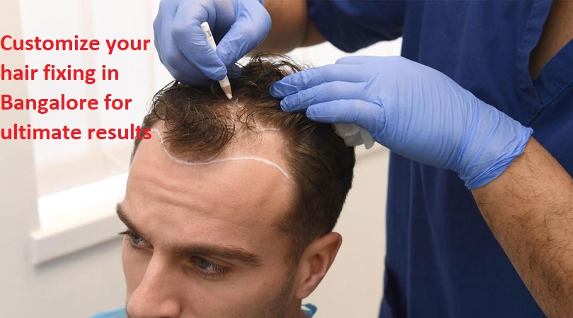 Customize your hair fixing in Bangalore