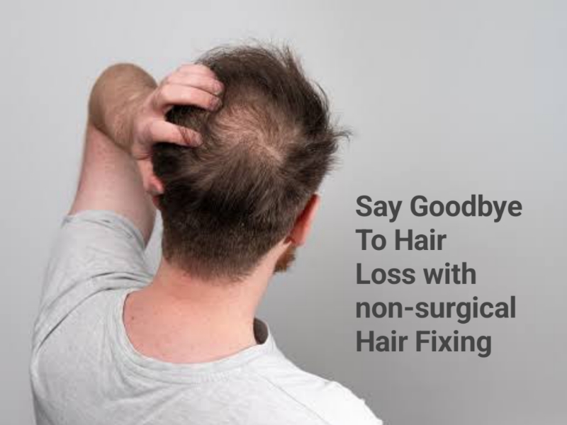 Say Goodbye To Hair Loss with non-surgical Hair Fixing