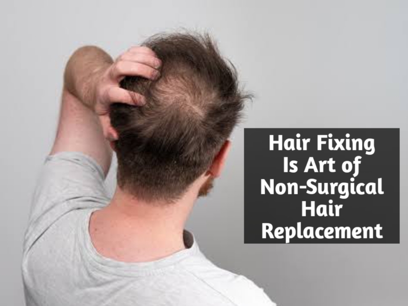 Hair Fixing Is Art of Non-Surgical Hair Replacement