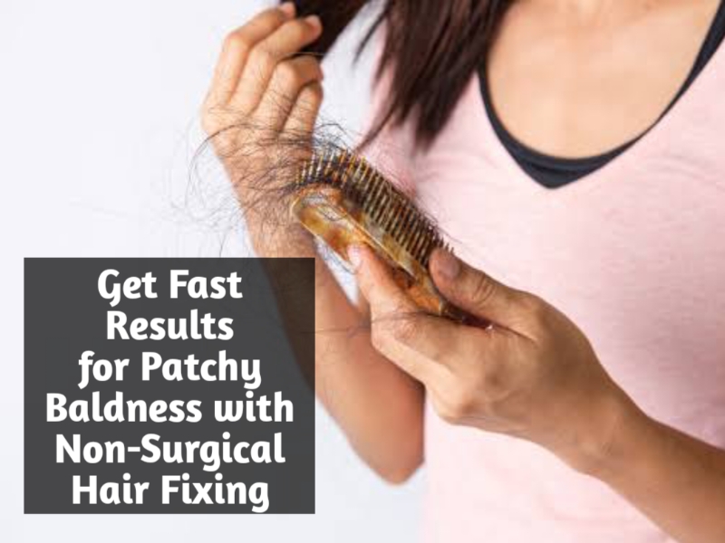 Get Fast Results for Patchy Baldness with Non-Surgical Hair Fixing