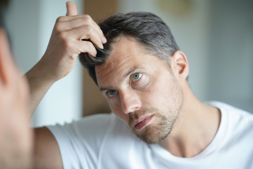 Hair fixing is considered as the best solution for male pattern baldness