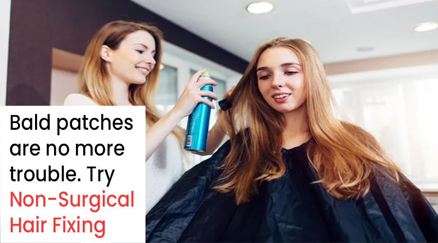 Bald patches are no more trouble