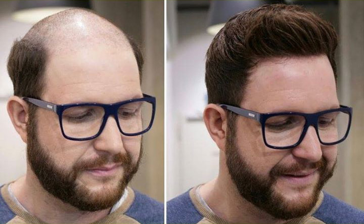 wigs design