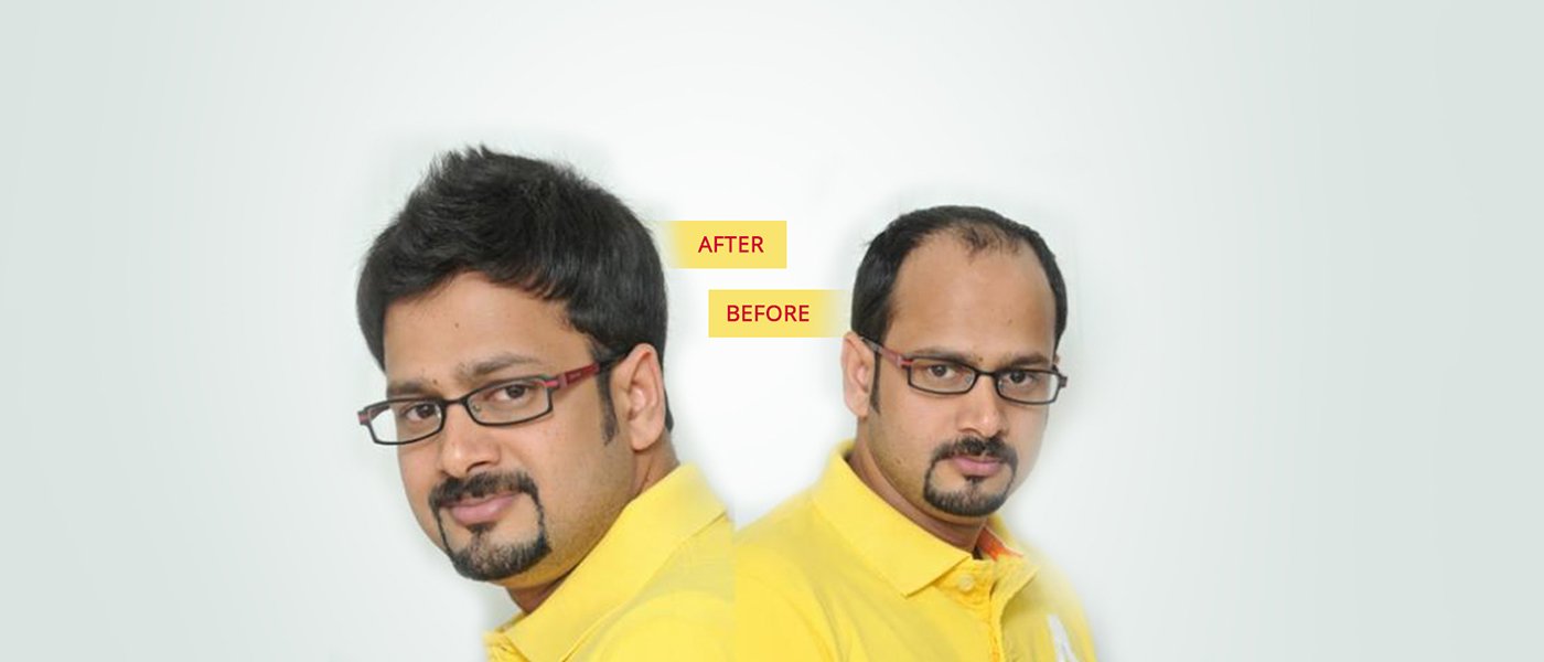 wigs design