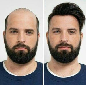 wigs design