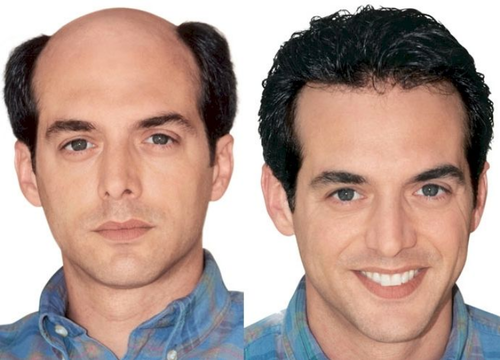 wigs design