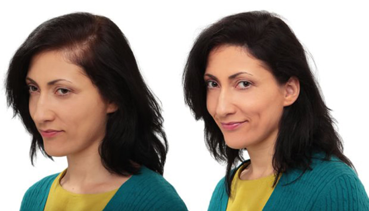 wigs design